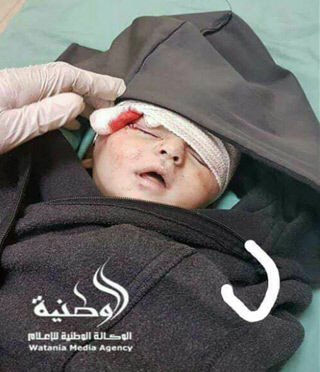 شهادت کودک 6 ماهه فلسطینی در حمله صهیونیست‌ها +تصویر