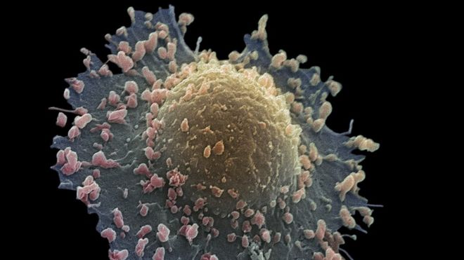 رهاسازی دارو در تومور سرطان ریه با نانوذرات امکان‌پذیر شد