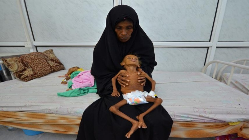 یمن تبدیل به جهنم کودکان شده است