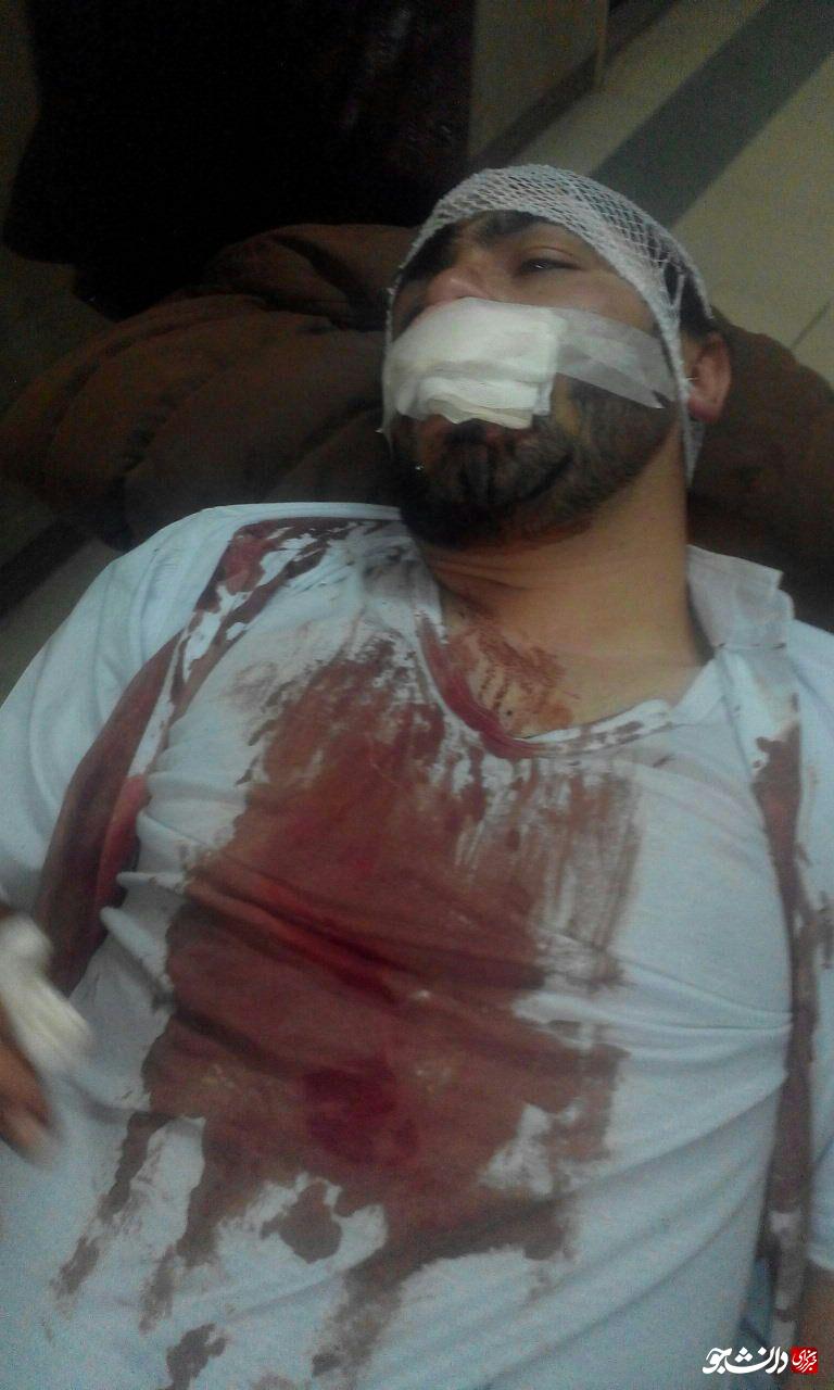 شکستن سر و گونه و حراجت شدید صورت دانشجوی دانشگاه پیام نور همدان/ جنایات اغتشاشگران با برنامه قبلی پشتیبانی میشد شکستن سر و گونه و حراجت شدید صورت دانشجوی دانشگاه پیام نور همدان/ جنایات اغتشاشگران با برنامه قبلی پشتیبانی میشد