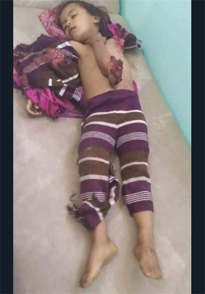 واکنش آل سعود به درج نام عربستان در لیست سیاه سازمان ملل واکنش آل سعود به درج نام عربستان در لیست سیاه سازمان ملل
