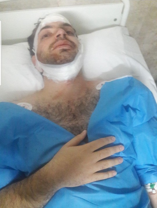 مسئول بسیج دانشجویی دانشگاه آزاد کرمانشاه مورد حمله افراد اشناس قرار گرفت+ تصاویر