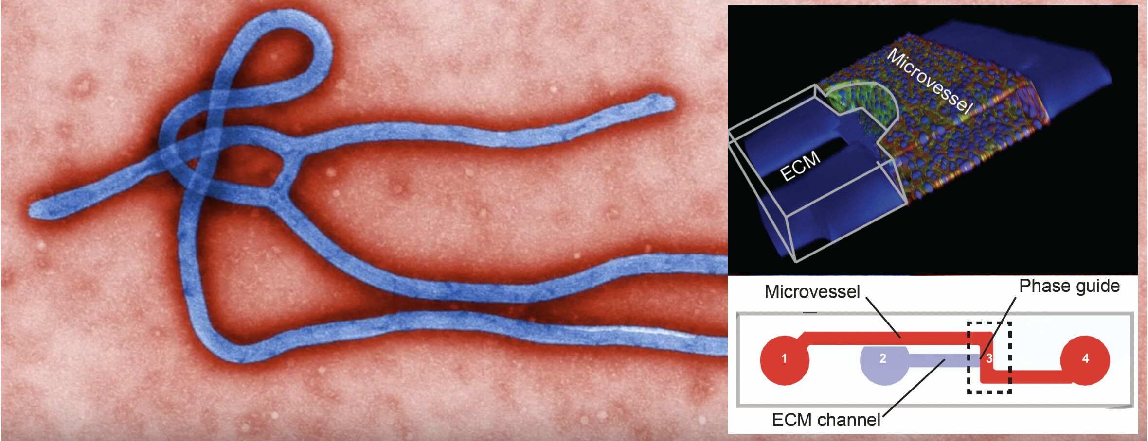 مهندسی بیماری ابولا روی میکروچیپ / نخستین مدل انسانی ابولا تولید شد