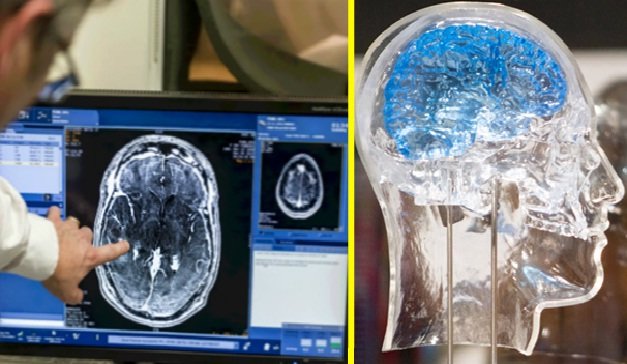 راه اندازی بانک اطلاعاتی تصویربرداری مغز در کشور/ شبکه آزمایشگاه‌های نقشه‌برداری در استان‌های مختلف تاسیس می‌شود