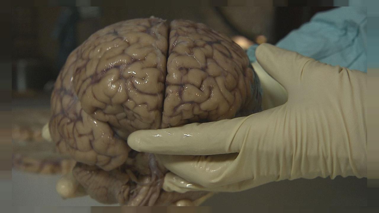 محققان با مادون قرمز نمای درونی مغز را دیدند