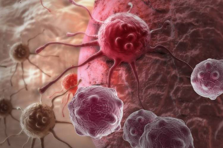 درمان سرطان پانکراس به کمک نانوذرات پپتیدی بهبود می‌یابد