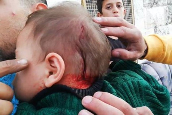 زخمی شدن نوزاد فلسطینی 