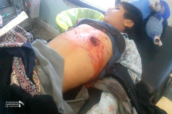 توافق الحدیده ۶۸ بار نقض شد/ شهادت و مجروحیت ۳ کودک یمنی