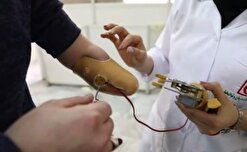 نخستین پروتز دست روباتیک ایرانی به تولید انبوه رسید