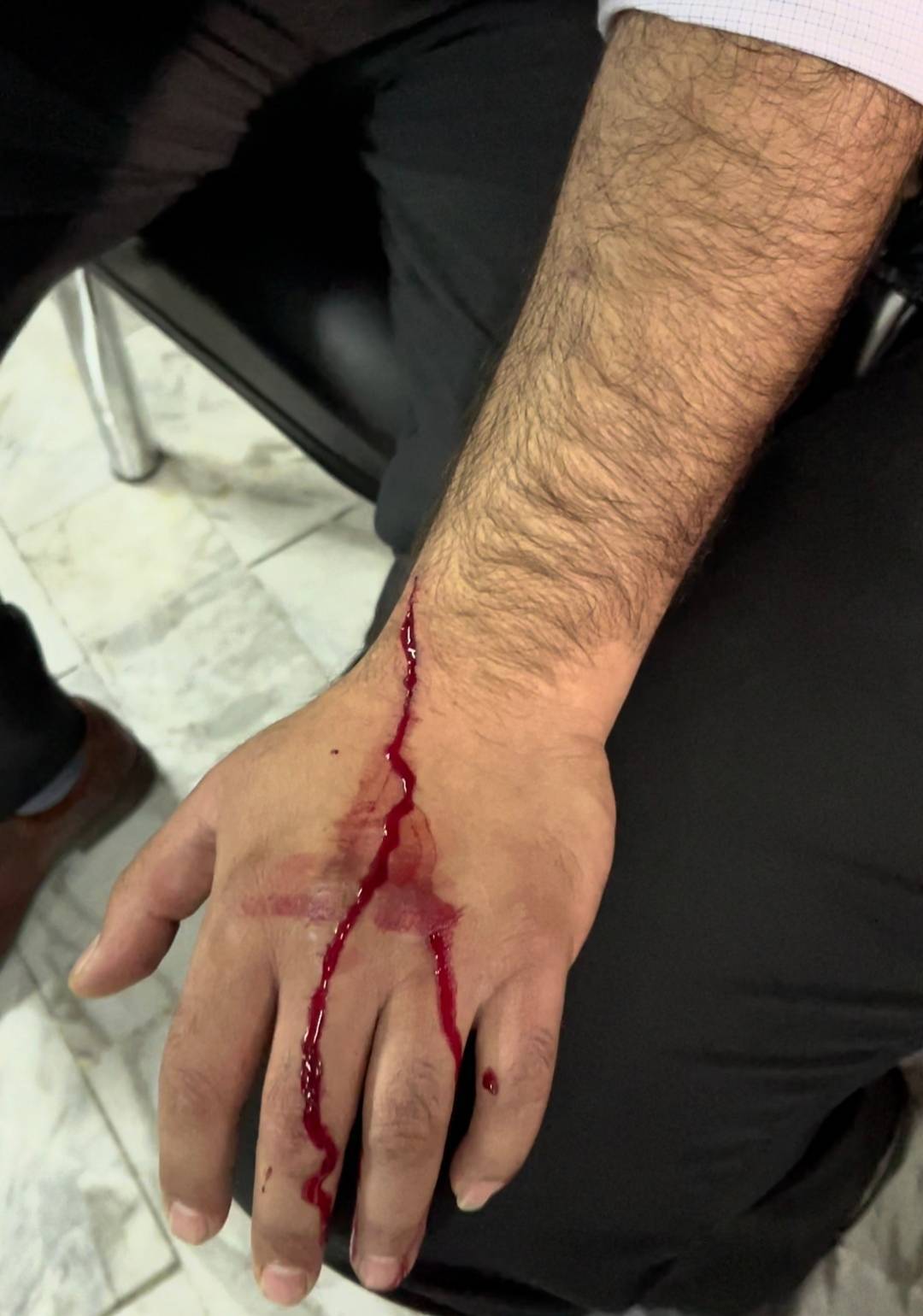 مجروحیت دو نفر از کارکنان حراست دانشگاه تهران با چاقوی اغتشاشگران