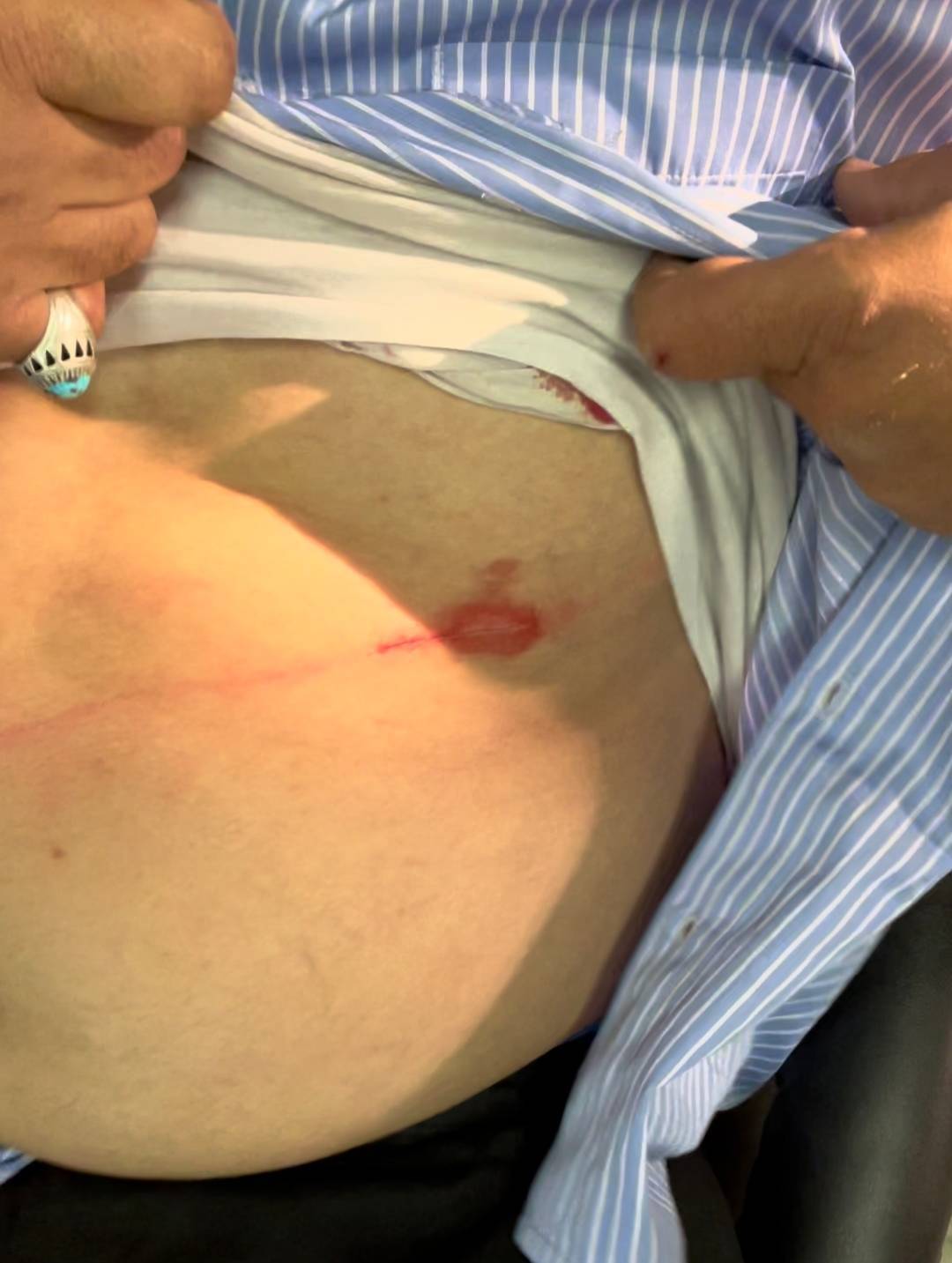مجروحیت دو نفر از کارکنان حراست دانشگاه تهران با چاقوی اغتشاشگران