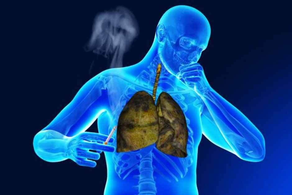 3 بیماری تنفسی پاییزی که سلامت را تهدید می‌کنند