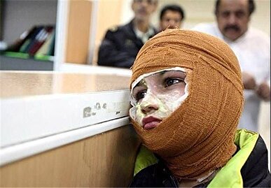 مصدومان چهارشنبه‌سوری در لرستان ۱۰۰ درصد افزایش یافت