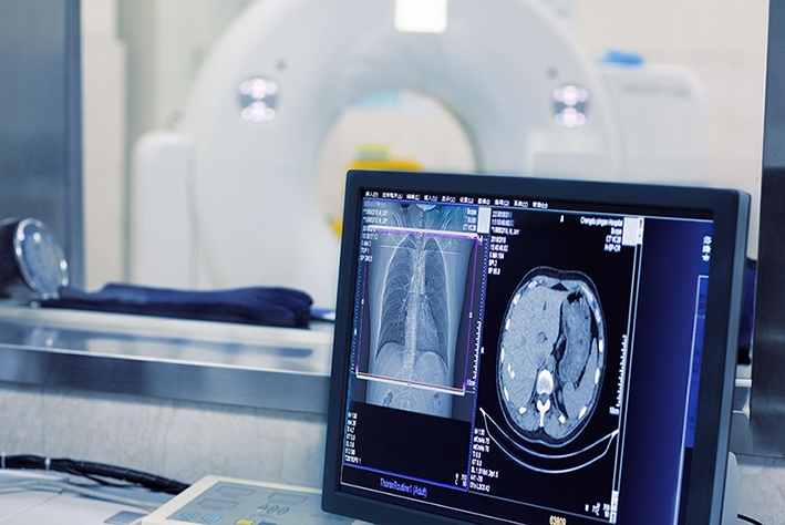 ارائه جدیدترین دستاورد‌های هوش مصنوعی در تصویربرداری پزشکی