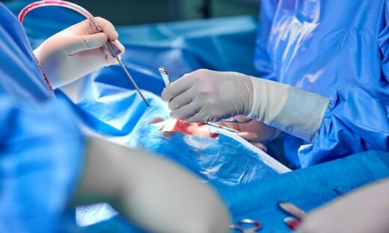 جراحی قطع تشنج کودکان در دانشگاه علوم پزشکی ایران / بی‌نیازی از اعزام بیمار به ژاپن