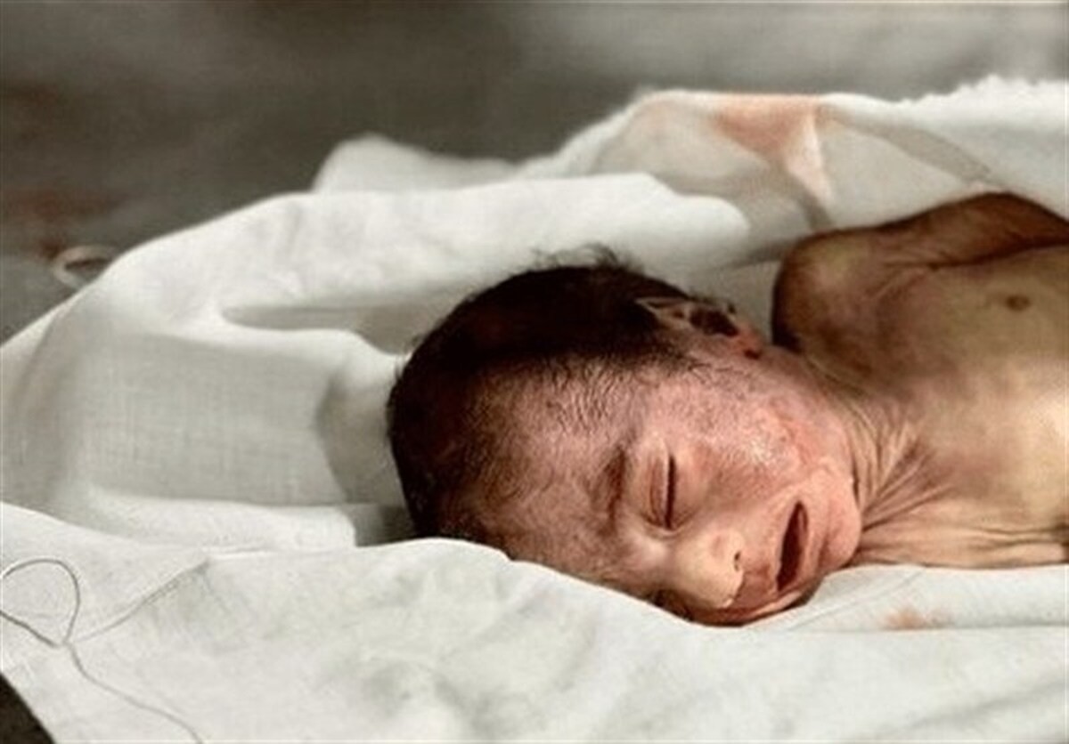 شهادت یک نوزاد دیگر در غزه از سرما