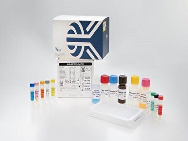 تولید ۷ کیت تشخیصی با صرفه‌جویی ارزی ۱۷ میلیون دلاری