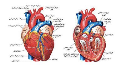 امکان افزایش دقت نمایش عروق کرونری قلب درکشور با روش‌های مبتنی بر هوش مصنوعی