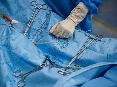 برخی افراد جان خود را برای عمل‌های زیبایی کاملا غیرضروری به خطر می‌اندازند/ نقش بلاگر‌های فضای مجازی در تبلیغات فریبنده + فیلم