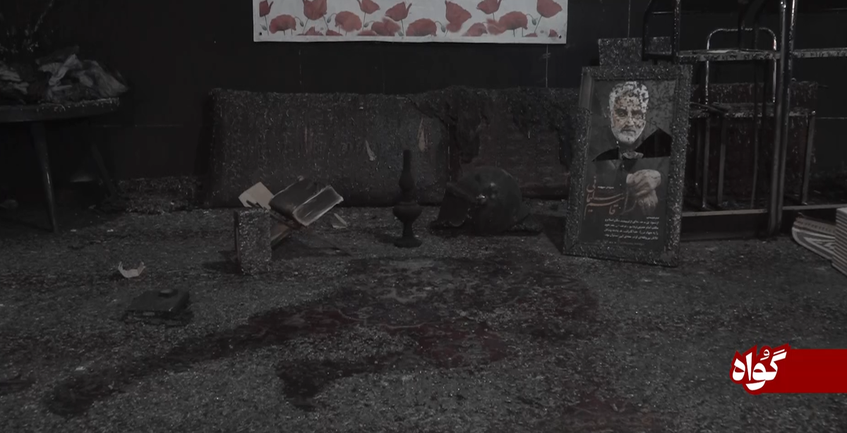 صورت سوخته او، گواه مظلومیت فرزندان این وطن است + فیلم