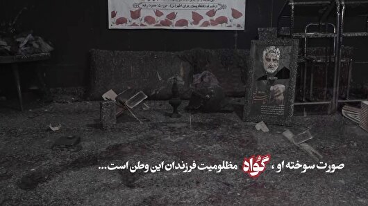 صورت سوخته او، گواه مظلومیت فرزندان این وطن است