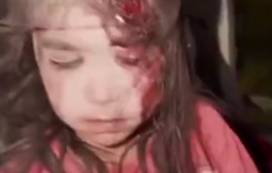 کودکان هدف حملات رژیم صهیونیستی و آمریکا