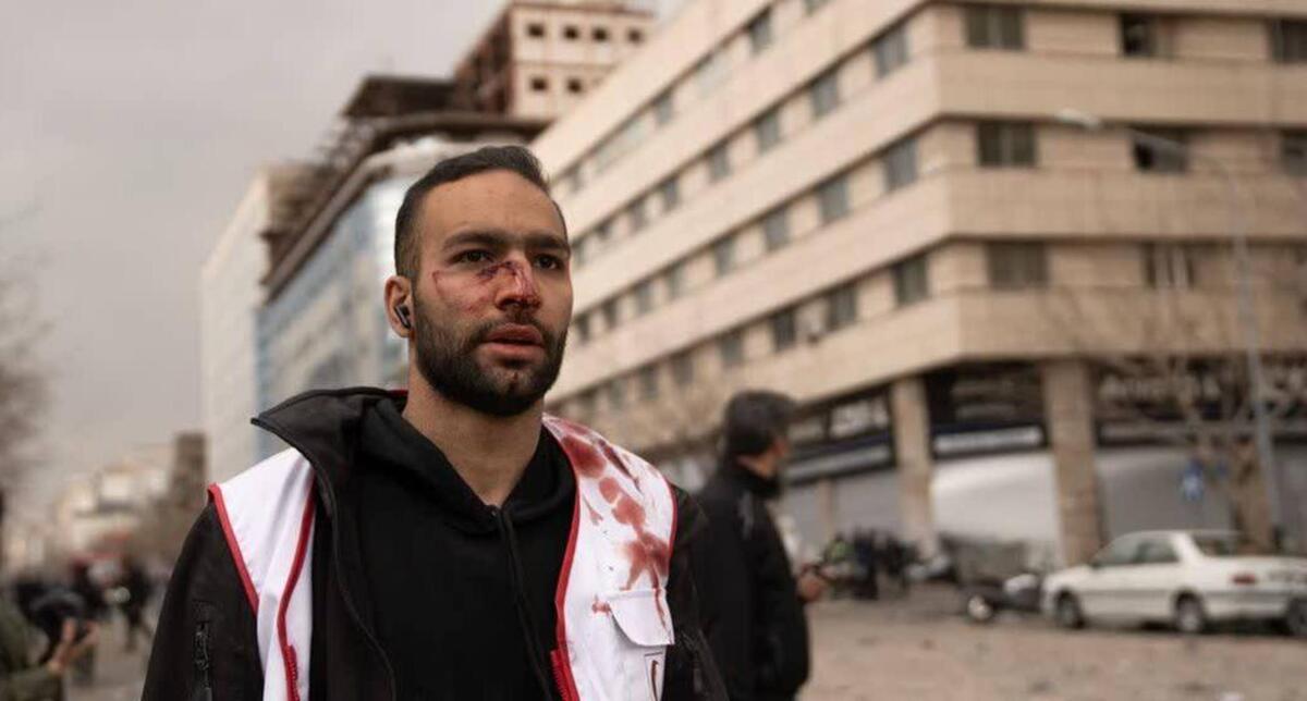 وقتی جنگ به اتاق کودکان رسید/ روایت یک امدادگر که در محل انفجار زخمی&zwnj;شد، اما کمک رسانی را متوقف نکرد