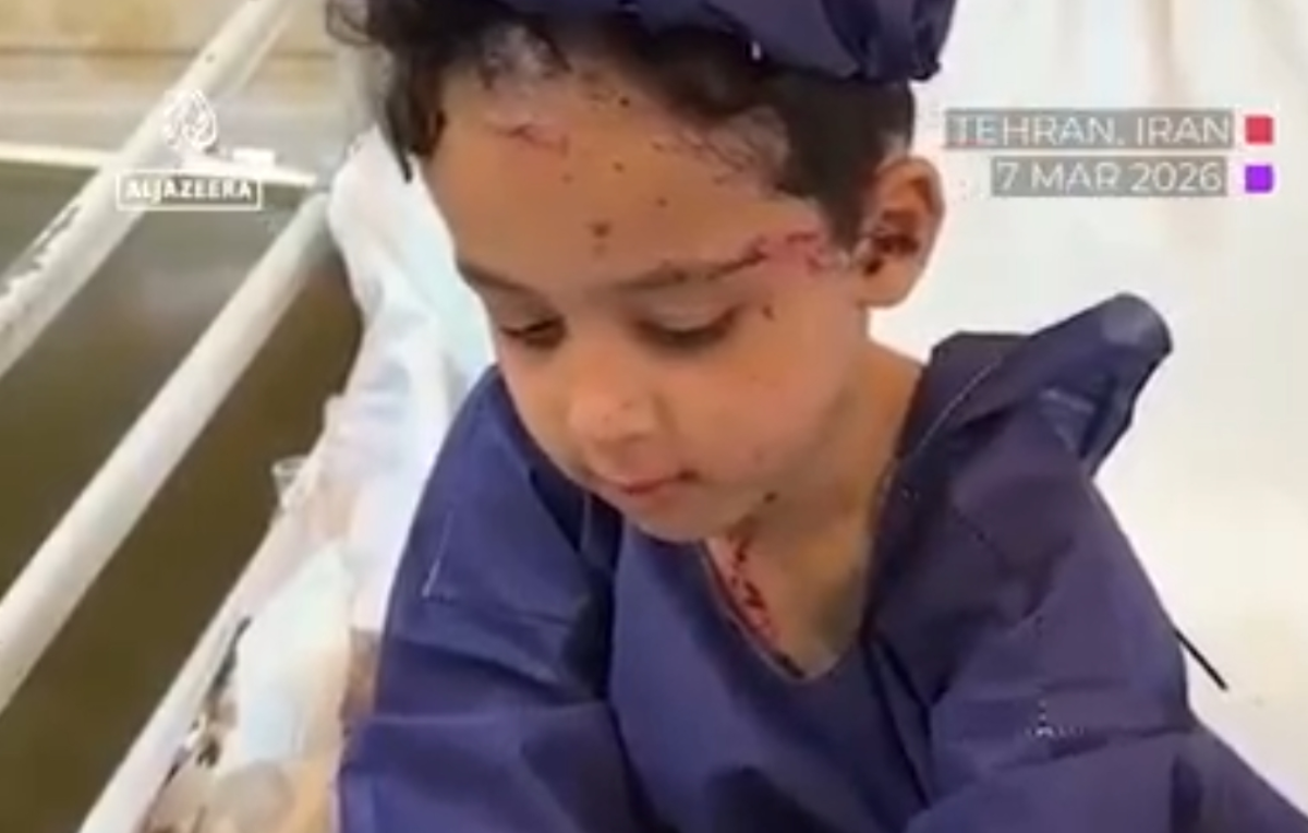 گزارش الجزیره از کودکان مجروح جنگ در بیمارستان مفید تهران