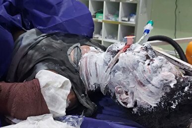 ۷۲ مصدومِ چهارشنبه سوری تا این لحظه