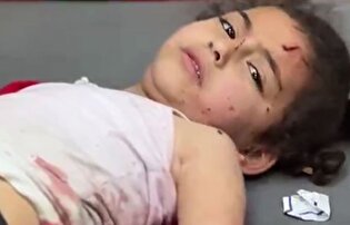 زخمی شدن کودکان در حمله هوایی به خان‌یونس
