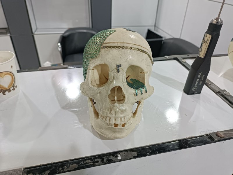 از شکست یک ابزار جراحی تا ساخت بزرگ&zwnj;ترین کارخانه کاشتنی&zwnj;های زیستی