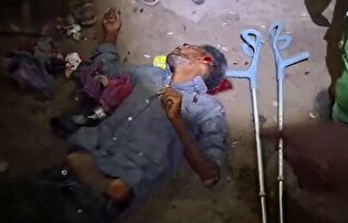 او پایی برای فرار از حملات صهیونیست‌ها نداشت!