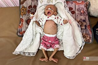 تراژدی قحطی در نوار غزه