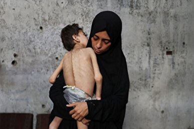 سخنگوی یونیسف: بیش از ۵ هزار کودک غزه طی دو هفته دچار سوء تغذیه شده‌اند