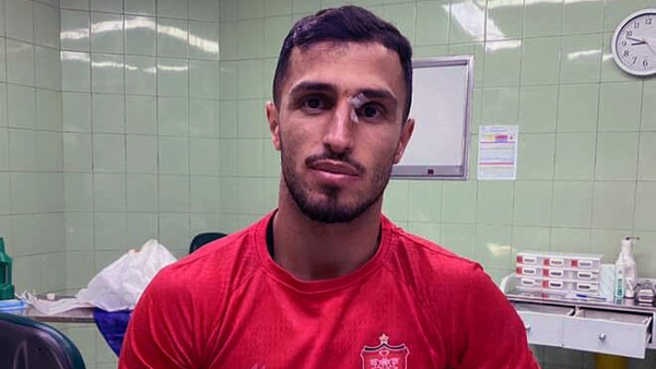 علی علیپور خانه نشین شد +عکس علی علیپور خانه نشین شد +عکس