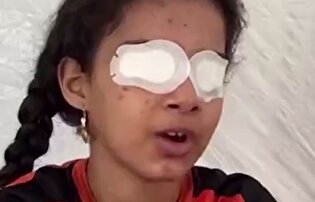 در بمباران رژیم صهیونیستی خانواده و بیناییم را از دست دادم