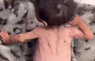 پسرم جلوی چشمانم دارد از گرسنگی جان می‌دهد