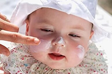 آفتاب سوختگی در کودکی، خطر ابتلا به سرطان پوست را افزایش می‌دهد