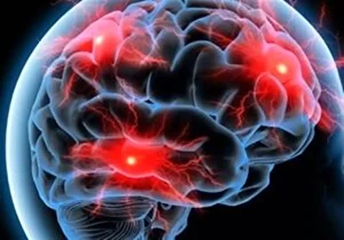 دستاورد هسته‌ای دیگر از محققین ایرانی درباره رادیوداروها