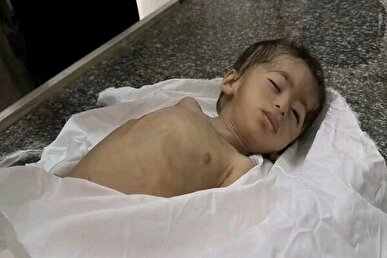 جان باختن ۷ نفر دیگر از جمله یک کودک بر اثر گرسنگی در غزه