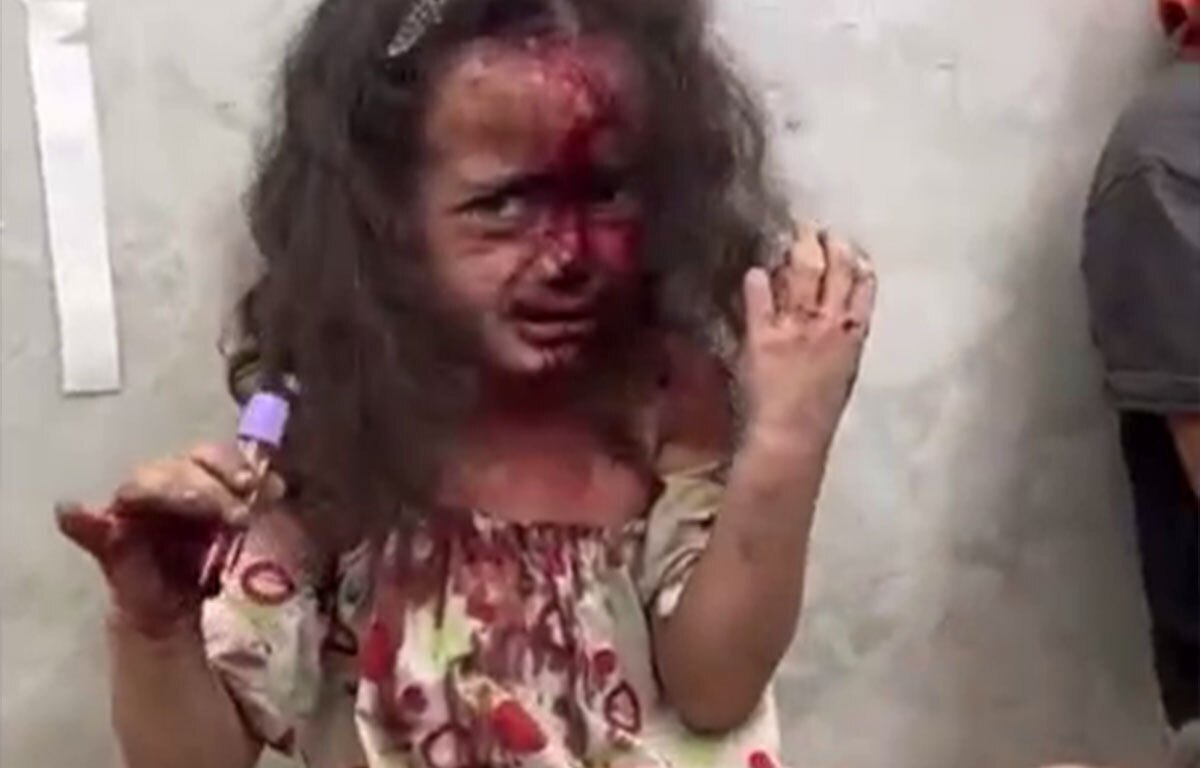 کودکان، قربانیان بی‌گناه حملات رژیم صهیونیستی