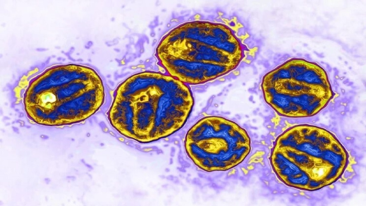 کابرد مهندسی بافت در پیوند استخوان/ موثر بودن مهندسی بافت و فناوری های نوظهور در درمان دندان پزشکی