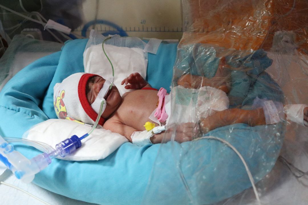 پنج قلو‌های کرمانی به دنیا آمدند