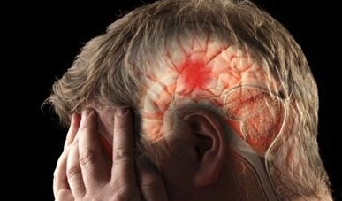زمان طلاست / سکته مغزی را بشناسید + فیلم
