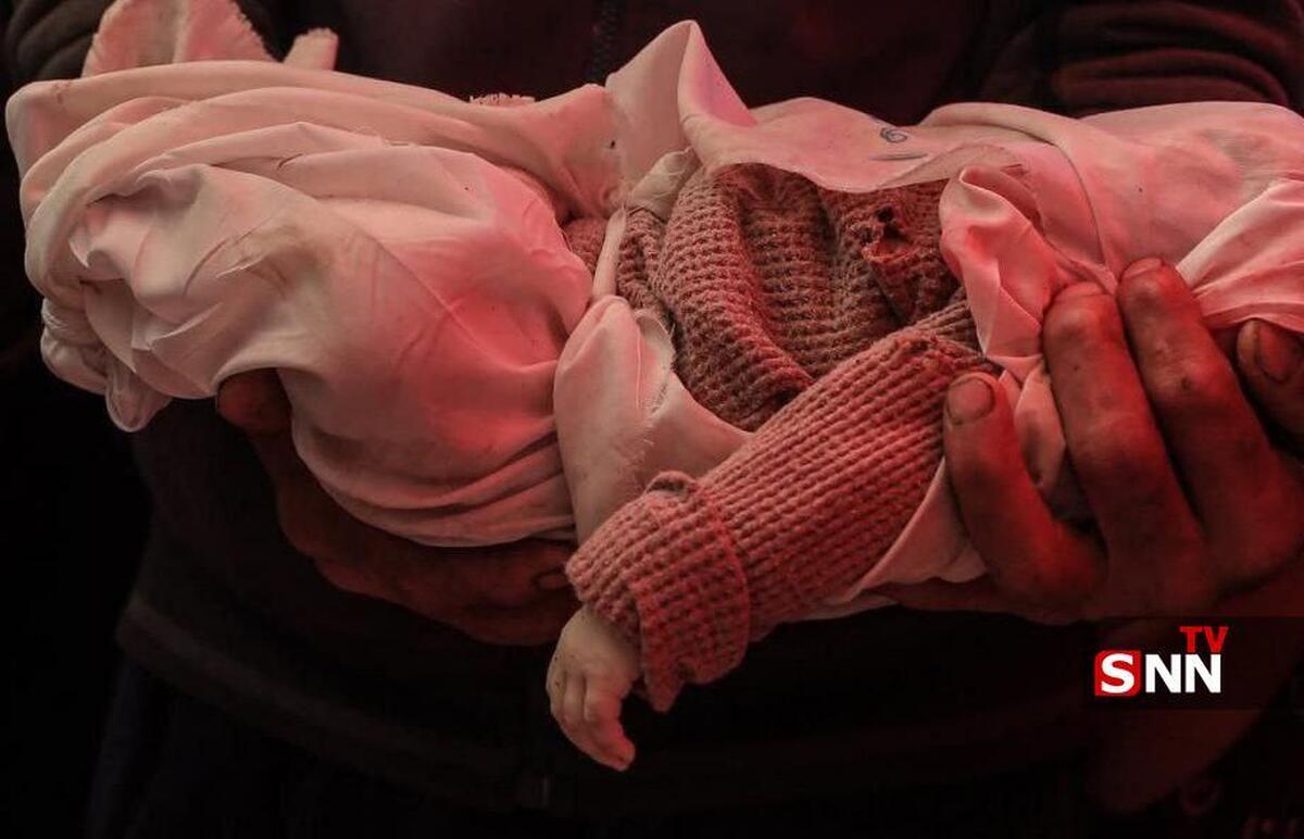 مرگ خاموش کودکان غزه با سلاح‌های نامرئی نسل‌کشی رژیم صهیونیستی