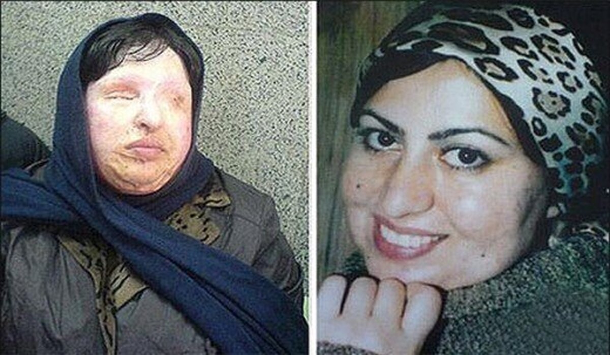 آمنه بهرامی بعد از 21 سال در دادسرای جنایی تهران / ماجرای بخشش دیه در زمان قصاص چی بود؟