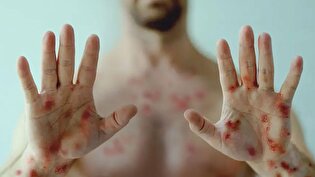 ۴۰٪ مبتلایان HIV مراجعه نمی‌کنن