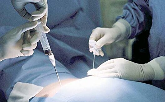 پیوند امید / ایران چگونه به یکی از بازیگران مهم سلول‌درمانی جهان تبدیل شد؟