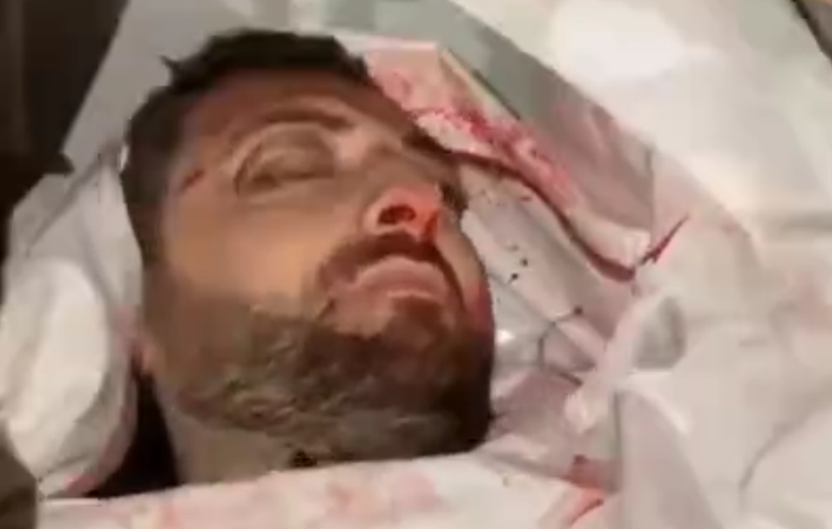 شهادت خبرنگار الجزیره در حمله رژیم صهیونیستی به غرب غزه