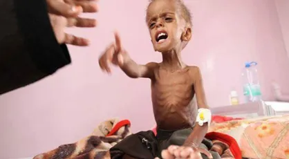 مقامات یمن و شبکه&zwnj;های اجتماعی: سازمان ملل با انسانیت کاسبی می&zwnj;کند